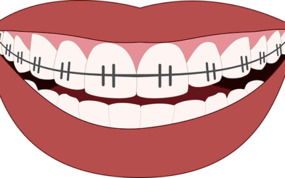 Comment améliorer la dentition d’un enfant?