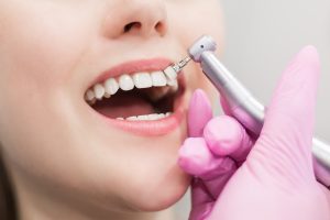 dentiste-dents