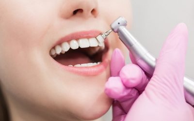 Quelques conseils utiles pour un beau sourire