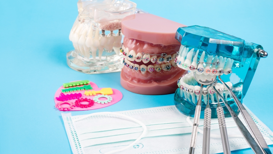 Tout ce qu’il faut savoir sur l’orthodontie