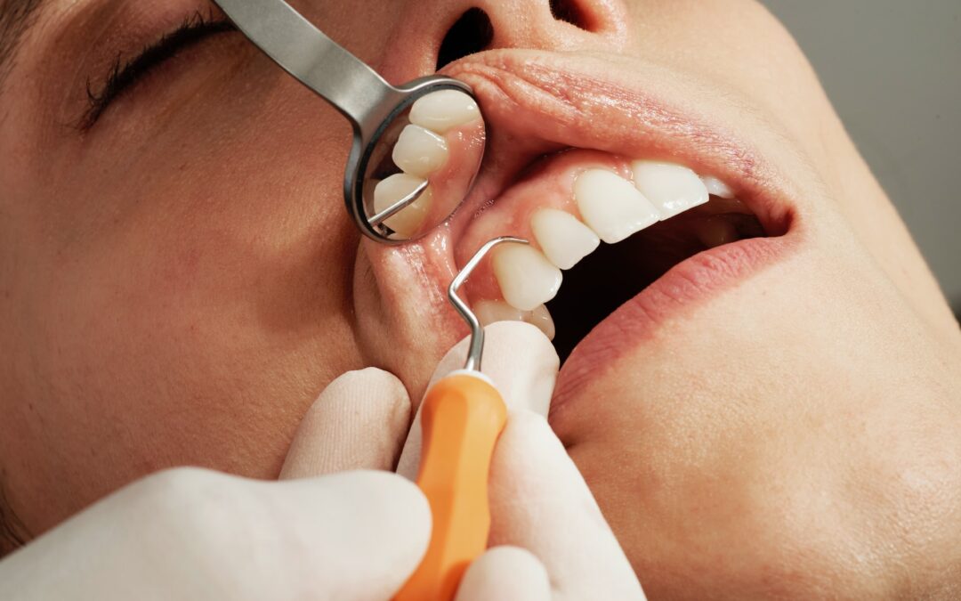 Tour d’horizon sur l’implant dentaire et son importance
