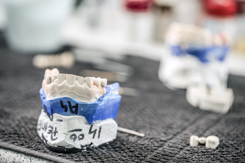 Moule dentaire avec numérotation des dents pour identifier les quadrants - Numéro des dents